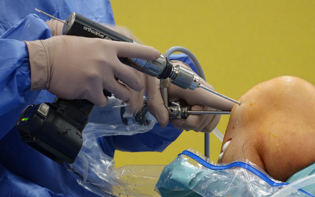 Cirugía mínimamente invasiva: Menos cicatrices, recuperación más rápida